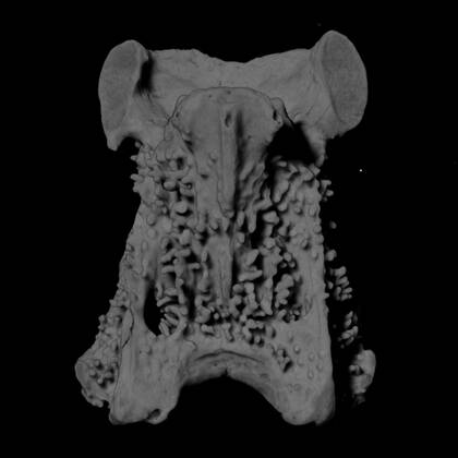 Volume rendering of the cervical vertebra